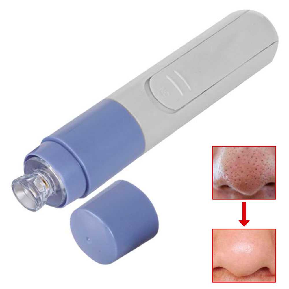 Cepillo Limpiador Facial Succionador Electrico de Poros Puntos Negros Pila AA Blackhead Remover Acne Facial Extractor